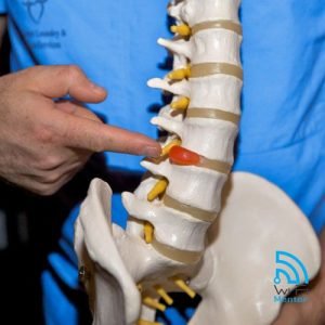 Herniated Disk and Back Pain online course WiFi Mentor
